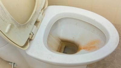 Lees meer over het artikel Urinesteen en kalk in toilet verwijderen